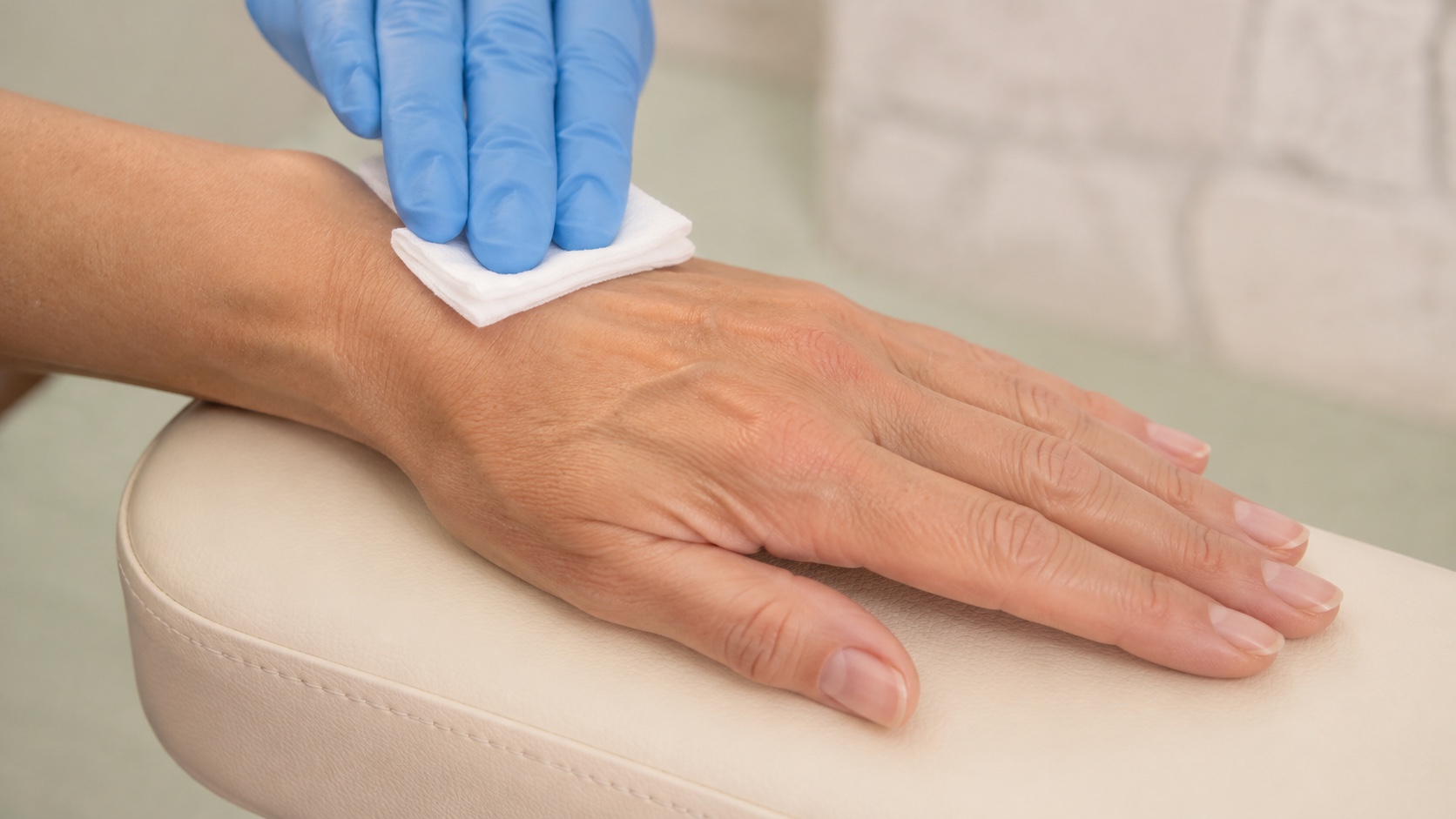 Back of a woman's hand resting on a cream cushion while a gloved hand prepares the skin with gauze