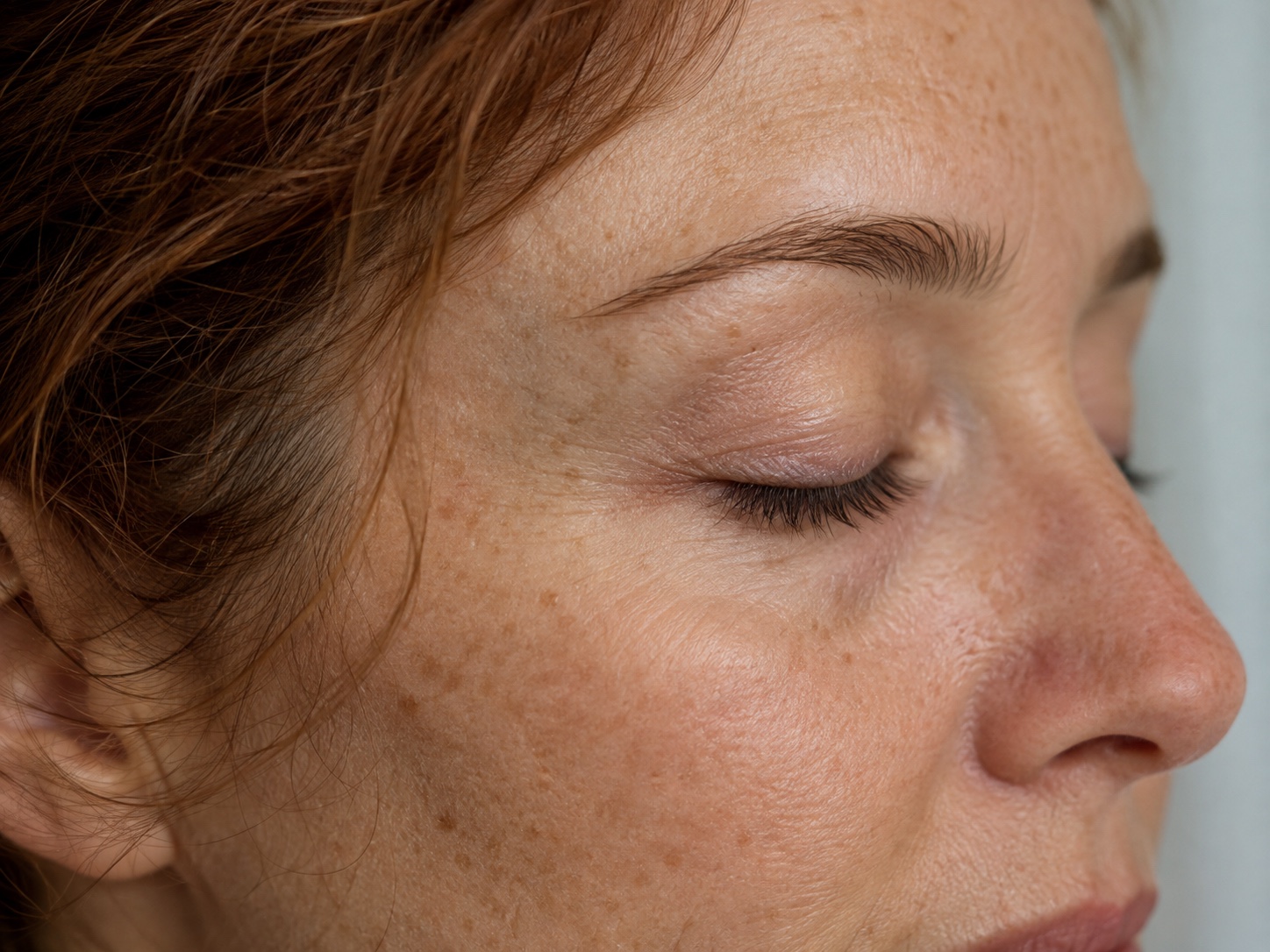 Close side view of a woman’s natural lower-eyelid and upper-cheek contours