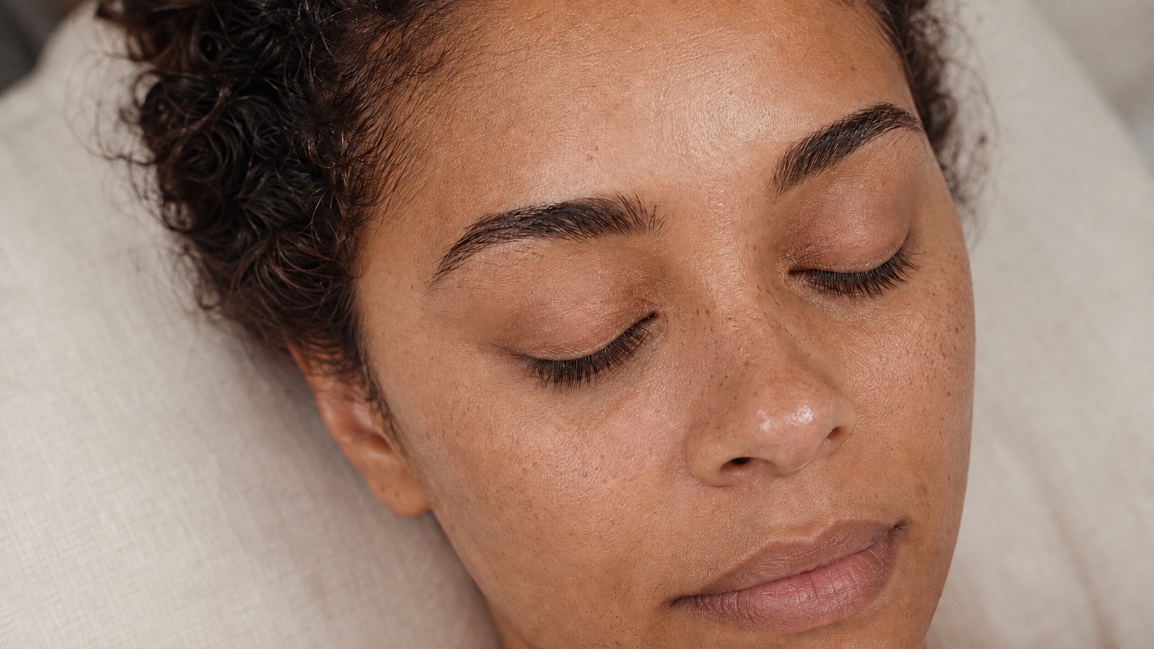 Woman resting before tear trough treatment, showing natural under-eye contours
